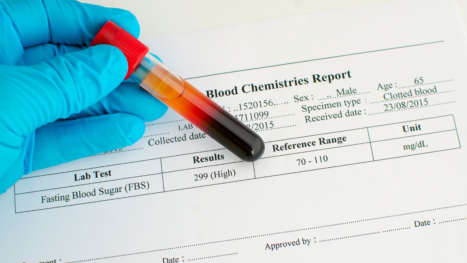 The Accuracy of a Blood Glucose Meter vs. a Lab Test and Why It Matters